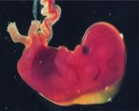EQUIPO OBSTETRICO
Unidad Perinatal
Diagn�stico Pre-Natal
Tamizaje prenatal de defectos cong�nitos
TRANSLUCENCIA NUCAL