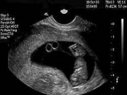 EQUIPO OBSTETRICO
Unidad Perinatal
Ecograf�as
Calendario de Ecograf�as