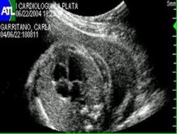 EQUIPO OBSTETRICO
Unidad Perinatal
Ecograf�as
Calendario de Ecograf�as
CORAZON CUATRO CAMARAS CARDIACAS